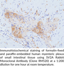 SV2A Rabbit Monoclonal Antibody (Clone RM520)