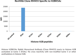 Histone H2BK5Ac Rabbit Monoclonal Antibody (Clone RM455)
