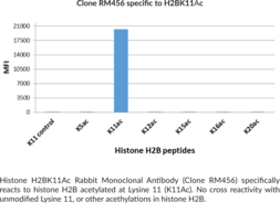 Histone H2BK11Ac Rabbit Monoclonal Antibody (Clone RM456)