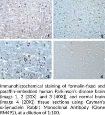 α-Synuclein Rabbit Monoclonal Antibody (Clone RM492)