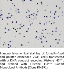 Histone H3K9M Rabbit Monoclonal Antibody (Clone RM191)