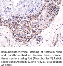 Akt (Phospho-Ser473) Rabbit Monoclonal Antibody (Clone RM251)