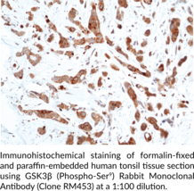 GSK3β (Phospho-Ser9) Rabbit Monoclonal Antibody (Clone RM453)