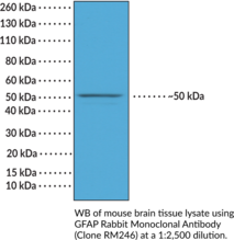 GFAP Rabbit Monoclonal Antibody (Clone RM246) (ALXDRD, Glial Fibrillary Acidic Protein Intermediate Filament Protein)
