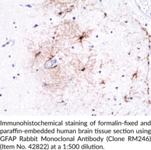 GFAP Rabbit Monoclonal Antibody (Clone RM246)