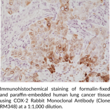 COX-2 Rabbit Monoclonal Antibody (Clone RM348)