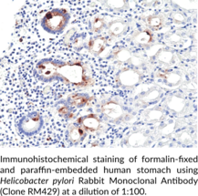 Helicobacter pylori Rabbit Monoclonal Antibody (Clone RM429)