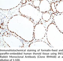 INI1 Rabbit Monoclonal Antibody (Clone RM468)