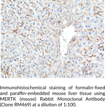 MERTK (mouse) Rabbit Monoclonal Antibody (Clone RM469)
