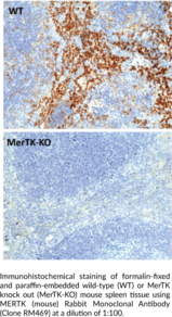 MERTK (mouse) Rabbit Monoclonal Antibody (Clone RM469)