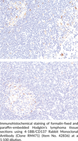 4-1BB/CD137 Rabbit Monoclonal Antibody (Clone RM471)