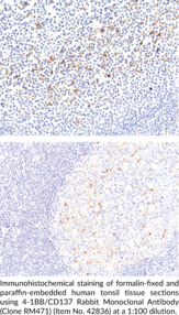 4-1BB/CD137 Rabbit Monoclonal Antibody (Clone RM471)