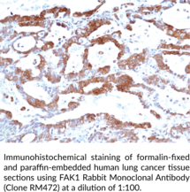FAK1 Rabbit Monoclonal Antibody (Clone RM472)