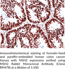 MSH2 Rabbit Monoclonal Antibody (Clone RM478)