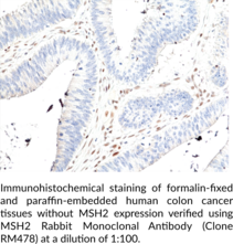 MSH2 Rabbit Monoclonal Antibody (Clone RM478)