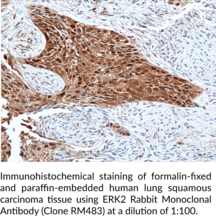 ERK2 Rabbit Monoclonal Antibody (Clone RM483)