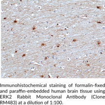 ERK2 Rabbit Monoclonal Antibody (Clone RM483)