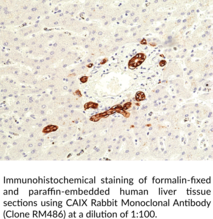 CAIX Rabbit Monoclonal Antibody (Clone RM486)