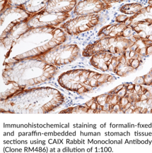 CAIX Rabbit Monoclonal Antibody (Clone RM486)