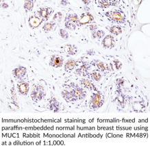 MUC1 Rabbit Monoclonal Antibody (Clone RM489)
