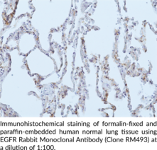 EGFR Rabbit Monoclonal Antibody (Clone RM493)