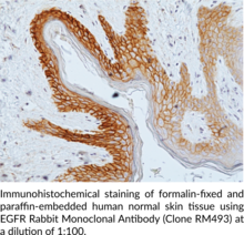 EGFR Rabbit Monoclonal Antibody (Clone RM493)