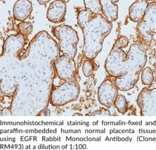 EGFR Rabbit Monoclonal Antibody (Clone RM493)