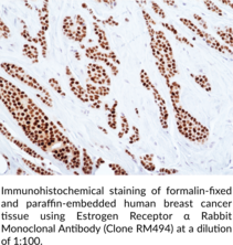 Estrogen Receptor α Rabbit Monoclonal Antibody (Clone RM494)