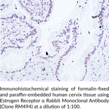 Estrogen Receptor α Rabbit Monoclonal Antibody (Clone RM494)