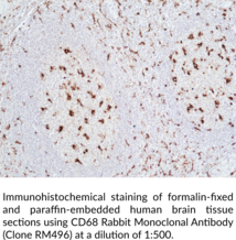 CD68 Rabbit Monoclonal Antibody (Clone RM496)