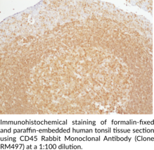 CD45 Rabbit Monoclonal Antibody (Clone RM497)