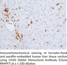 CD45 Rabbit Monoclonal Antibody (Clone RM497)