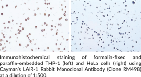 LAIR-1 Rabbit Monoclonal Antibody (Clone RM498)