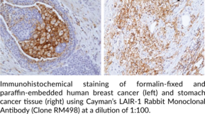 LAIR-1 Rabbit Monoclonal Antibody (Clone RM498)