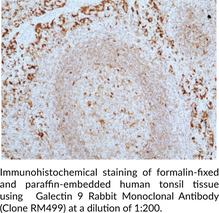 Galectin 9 Rabbit Monoclonal Antibody (Clone RM499)