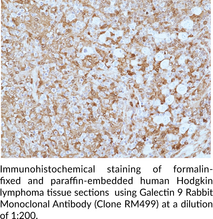 Galectin 9 Rabbit Monoclonal Antibody (Clone RM499)