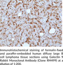 Galectin 9 Rabbit Monoclonal Antibody (Clone RM499)