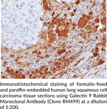Galectin 9 Rabbit Monoclonal Antibody (Clone RM499)