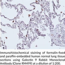Galectin 9 Rabbit Monoclonal Antibody (Clone RM499)
