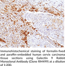 Galectin 9 Rabbit Monoclonal Antibody (Clone RM499)