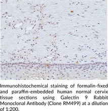 Galectin 9 Rabbit Monoclonal Antibody (Clone RM499)