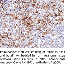 Galectin 9 Rabbit Monoclonal Antibody (Clone RM499)