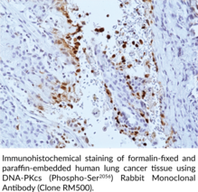DNA-PKcs (Phospho-Ser2056) Rabbit Monoclonal Antibody (Clone RM500)