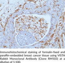 VISTA Rabbit Monoclonal Antibody (Clone RM503)