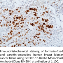 GCDFP-15 Rabbit Monoclonal Antibody (Clone RM504)