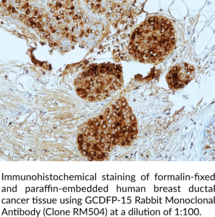 GCDFP-15 Rabbit Monoclonal Antibody (Clone RM504)