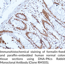 DNA-PKcs Rabbit Monoclonal Antibody (Clone RM505)