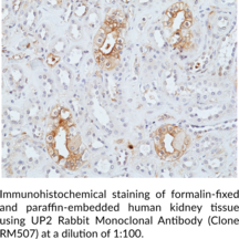 UP2 Rabbit Monoclonal Antibody (Clone RM507)