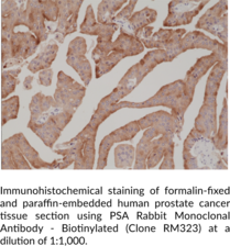 PSA Rabbit Monoclonal Antibody - Biotinylated (Clone RM323)