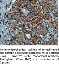 B-RAFV600E Rabbit Monoclonal Antibody Biotinylated (Clone RM8)